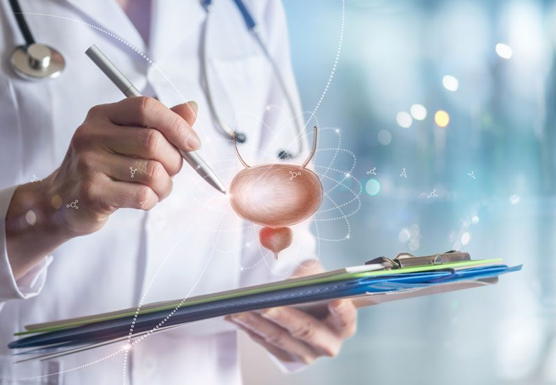Doctor-holding-clipboard-with-bladder-illustration-overlay Doctor-holding-clipboard-with-bladder-illustration-overlay