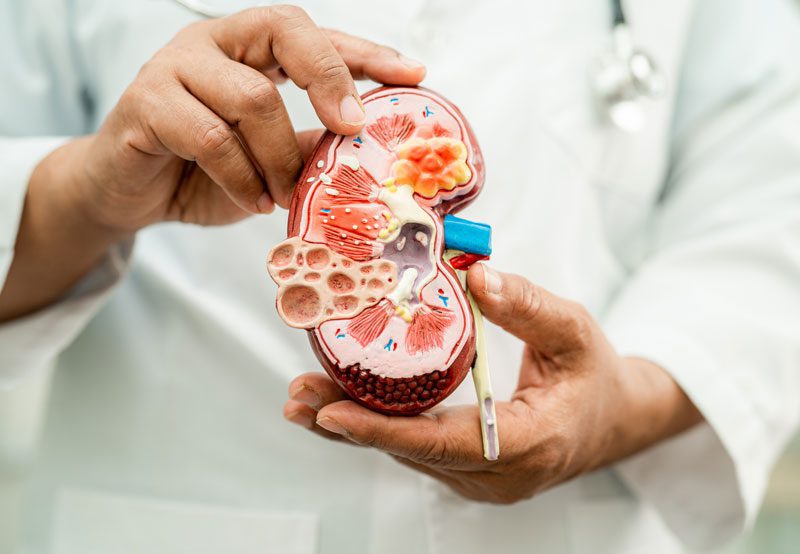 Doctor-holding-kidney-anatomy-model Doctor-holding-kidney-anatomy-model